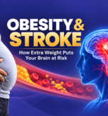 Obesity and Stroke How Extra Weight Puts Your Brain at Risk